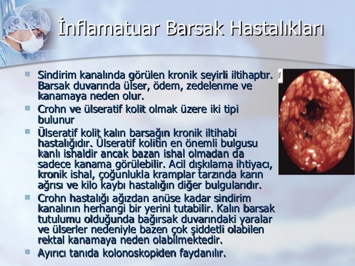inflamatuar barsak hastalklar